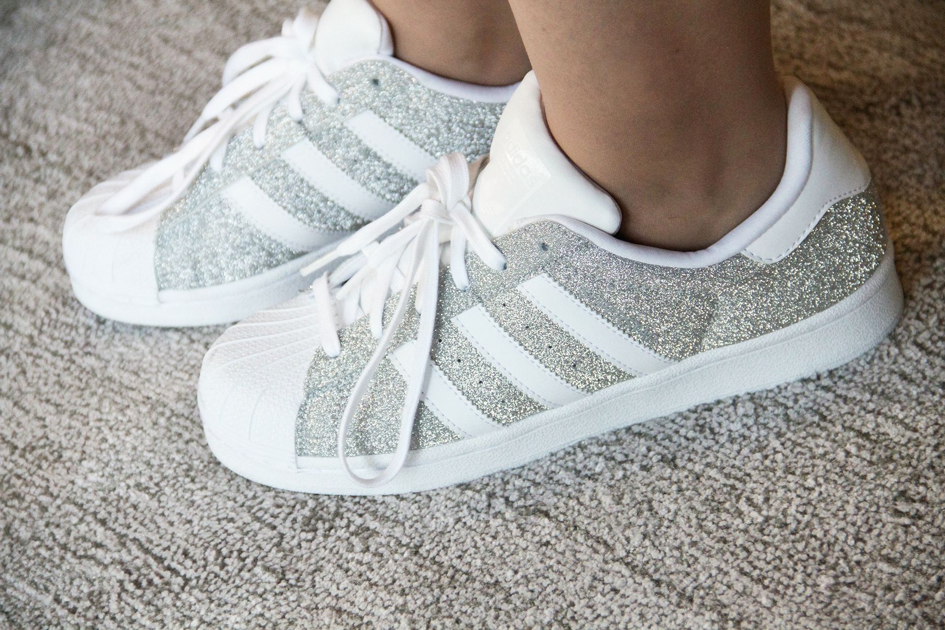gostei-e-agora-look-jaqueta-patches-jacket-vestido-listrado-adidas-superstar-branco-10